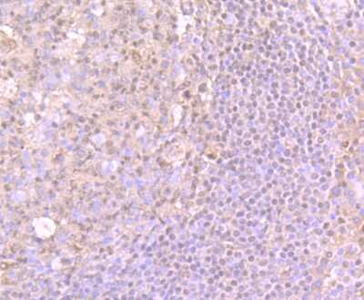 Immunohistochemistry-Paraffin: PU.1/Spi-1 Antibody (JB72-35) [NBP2-75637] - Analysis of paraffin-embedded human tonsil tissue using anti-PU.1/Spi1 antibody. Counter stained with hematoxylin.