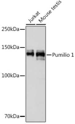 Western Blot: PUM1 Antibody (8Y6H5) [NBP3-15279] - Western blot analysis of extracts of various cell lines, using PUM1 Rabbit mAb (NBP3-15279) at 1:1000 dilution. Secondary antibody: HRP Goat Anti-Rabbit IgG (H+L) at 1:10000 dilution. Lysates/proteins: 25ug per lane. Blocking buffer: 3% nonfat dry milk in TBST. Detection: ECL Basic Kit. Exposure time: 10s.