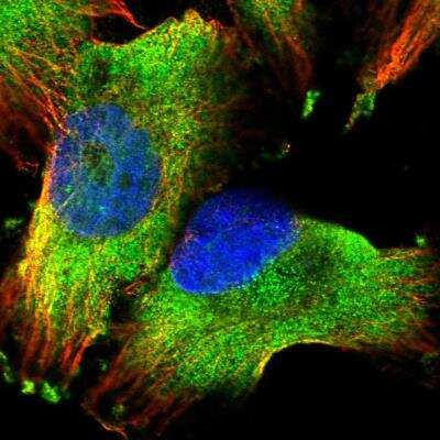 <b>Independent Antibodies Validation. </b>Immunocytochemistry/Immunofluorescence: PUM1 Antibody [NBP1-87856] - Staining of human cell line U-251 MG shows positivity in cytoplasm.