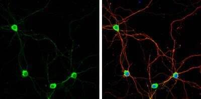 Immunocytochemistry/Immunofluorescence: PUM1 Antibody [NBP2-20011] - PUM1 antibody detects PUM1 protein by immunofluorescent analysis. Sample: DIV9 rat E18 primary hippocampal neuron cells were fixed in 4% paraformaldehyde at RT for 15 min. Green: PUM1 stained by PUM1 antibody diluted at 1:500. Red: beta Tubulin 3/ Tuj1, stained by beta Tubulin 3/ Tuj1 antibody diluted at 1:500. Blue: Fluoroshield with DAPI.