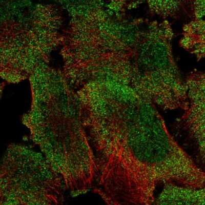 <b>Independent Antibodies Validation. </b>Immunocytochemistry/Immunofluorescence: PUM1 Antibody [NBP2-58337] - Staining of human cell line U-251 MG shows localization to nucleus & cytosol.