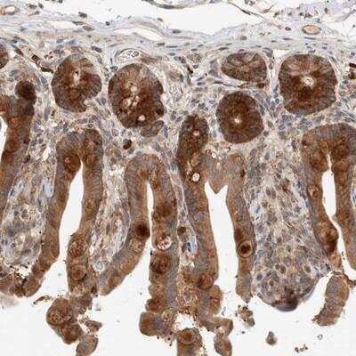 Immunohistochemistry-Paraffin: PUM1 Antibody [NBP1-87856] - Staining of human colon shows strong cytoplasmic positivity in glandular cells.