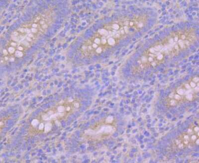 Immunohistochemistry-Paraffin: PUM1 Antibody (JG37-75) [NBP2-75638] - Analysis of paraffin-embedded human appendix tissue using anti-Pumilio 1 antibody. Counter stained with hematoxylin.