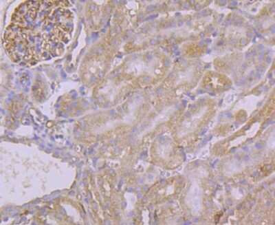 Immunohistochemistry-Paraffin: PUM1 Antibody (JG37-75) [NBP2-75638] - Analysis of paraffin-embedded mouse kidney tissue using anti-Pumilio 1 antibody. Counter stained with hematoxylin.