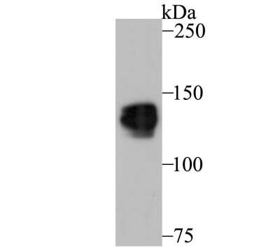 Western Blot: PUM1 Antibody (JG37-75) [NBP2-75638] - Analysis of Pumilio 1 on SiHa cell using anti-Pumilio 1 antibody at 1/1,000 dilution.