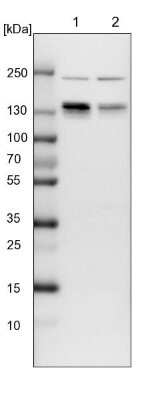 Western Blot: PUM1 Antibody [NBP1-87856] - Lane 1: NIH-3T3 cell lysate (Mouse embryonic fibroblast cells). Lane 2: NBT-II cell lysate (Rat Wistar bladder tumor cells).