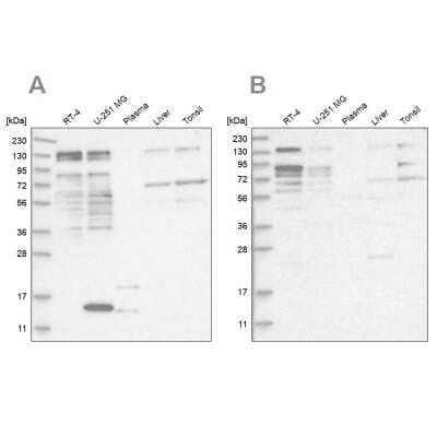 Western Blot: PUM1 Antibody [NBP1-87856] - Analysis using Anti-PUM1 antibody NBP1-87856 (A) shows similar pattern to independent antibody NBP2-58337 (B).