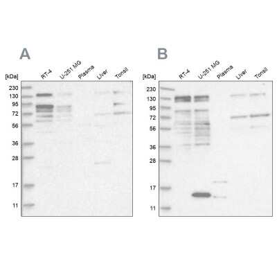 Western Blot: PUM1 Antibody [NBP2-58337] - Analysis using Anti-PUM1 antibody NBP2-58337 (A) shows similar pattern to independent antibody NBP1-87856 (B).