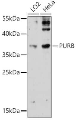 Western Blot: PURB Antibody [NBP2-94475] - Analysis of extracts of various cell lines, using PURB . Exposure time: 90s.
