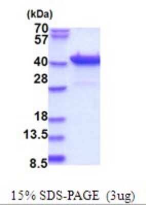 SDS-PAGE Recombinant Human PURB His Protein