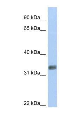 Western Blot: PURG Antibody [NBP1-79362] - 721_B cell lysate, concentration 0.2-1 ug/ml.