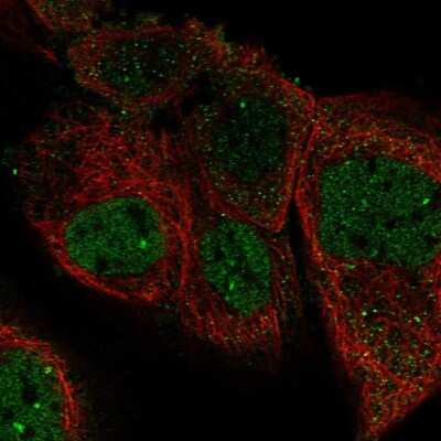 Immunocytochemistry/Immunofluorescence: PURL Antibody [NBP1-84691] - Staining of human cell line A-431 shows localization to nucleoplasm. Antibody staining is shown in green. Antibody staining is shown in green.