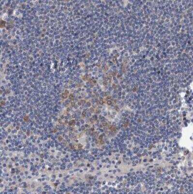 Immunohistochemistry-Paraffin: PURL Antibody [NBP1-84691] - Staining of human lymph node shows weak to moderate cytoplasmic positivity in germinal center cells.