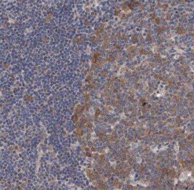 Immunohistochemistry-Paraffin: PURL Antibody [NBP1-84691] - Staining of human tonsil shows moderate cytoplasmic positivity in germinal cetner cells.