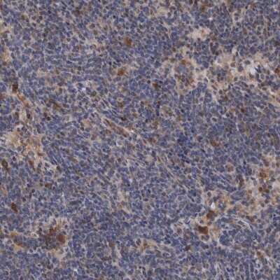 Immunohistochemistry-Paraffin: PURL Antibody [NBP1-84692] - Staining of human lymph node shows high expression.