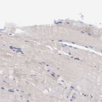 Immunohistochemistry-Paraffin: PURL Antibody [NBP1-84692] - Staining of human skeletal muscle shows low expression as expected.