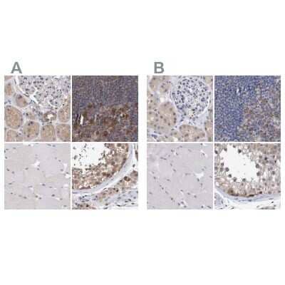 <b>Independent Antibodies Validation. </b>Immunohistochemistry-Paraffin: PURL Antibody [NBP1-84692] - Staining of human kidney, lymph node, skeletal muscle and testis using Anti-PFAS antibody NBP1-84692 (A) shows similar protein distribution across tissues to independent antibody NBP1-84691 (B).