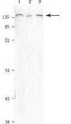 Western Blot: PURL Antibody [NBP1-70692] - 1. Human Skin Fibroblasts (100ug) 2. HEK273 cells (20ug) 3. HeLa skin cells(20ug) at 1:2,000.