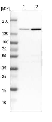 Western Blot: PURL Antibody [NBP1-84691] - Lane 1: NIH-3T3 cell lysate (Mouse embryonic fibroblast cells). Lane 2: NBT-II cell lysate (Rat Wistar bladder tumor cells).