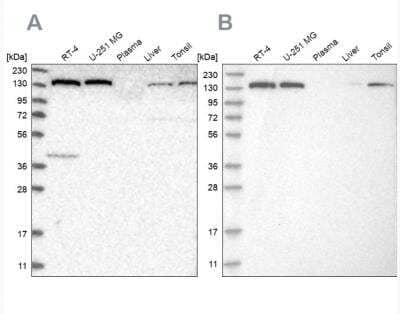 <b>Independent Antibodies Validation. </b>Western Blot: PURL Antibody [NBP1-84691] - Analysis using Anti-PFAS antibody NBP1-84691(A) shows similar pattern to independent antibody NBP1-84692 (B).