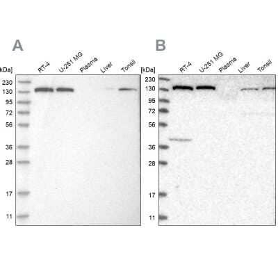 <b>Independent Antibodies Validation and Orthogonal Strategies Validation.</b>Western Blot: PURL Antibody [NBP1-84692] - Analysis using Anti-PFAS antibody NBP1-84692 (A) shows similar pattern to independent antibody NBP1-84691 (B).