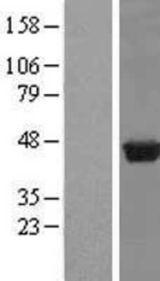 Western Blot: PUS1 Overexpression Lysate (Adult Normal) [NBP2-08975] Left-Empty vector transfected control cell lysate (HEK293 cell lysate); Right -Over-expression Lysate for PUS1.