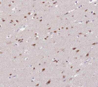 Immunohistochemistry-Paraffin: PUS10 Antibody [NBP2-48941] - Staining of human cerebral cortex shows moderate nuclear and cytoplasmic positivity in neuronal cells.