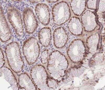 Immunohistochemistry-Paraffin: PUS10 Antibody [NBP2-48941] - Staining of human stomach shows moderate nuclear and ctyoplasmic positivity in glandular cells.
