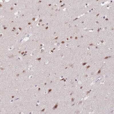Immunohistochemistry-Paraffin: PUS10 Antibody [NBP2-48941] - Staining of human Cerebral cortex shows moderate nuclear and cytoplasmic positivity in neuronal cells.