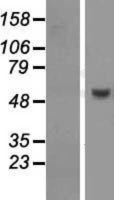 Western Blot: PUS10 Overexpression Lysate (Adult Normal) [NBL1-14998] Left-Empty vector transfected control cell lysate (HEK293 cell lysate); Right -Over-expression Lysate for PUS10.