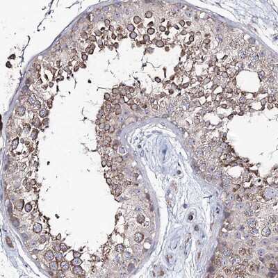 Immunohistochemistry-Paraffin PUS3 Antibody - BSA Free