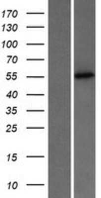 Western Blot: PUS3 Overexpression Lysate (Adult Normal) [NBP2-06135] Left-Empty vector transfected control cell lysate (HEK293 cell lysate); Right -Over-expression Lysate for PUS3.