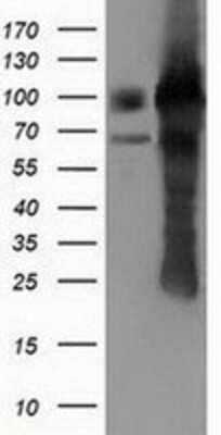 Western Blot: PUS7 Antibody (5F12) [NBP2-03112] - HEK293T cells were transfected with the pCMV6-ENTRY control (Left lane) or pCMV6-ENTRY PUS7 (Right lane) cDNA for 48 hrs and lysed. Equivalent amounts of cell lysates (5 ug per lane) were separated by SDS-PAGE and immunoblotted with anti-PUS7.