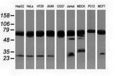 Western Blot: PUS7 Antibody (5F12) [NBP2-03112] Analysis of extracts (35ug) from 9 different cell lines by using anti-PUS7 monoclonal antibody.