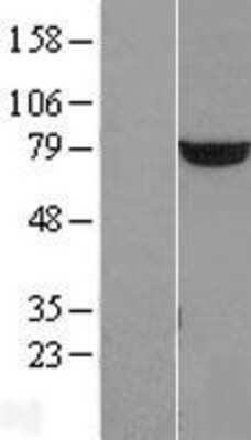 Western Blot PUS7 Overexpression Lysate