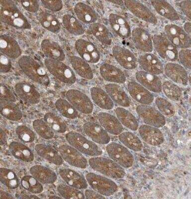 Immunohistochemistry-Paraffin: PUSL1 Antibody [NBP1-81876] - Staining of human duodenum shows moderate granular cytoplasmic positivity in glandular cells.