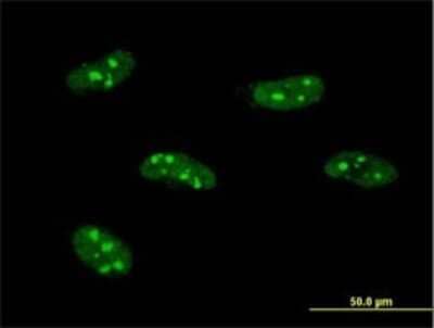 Immunocytochemistry/ Immunofluorescence PWP1 Antibody (3A11)