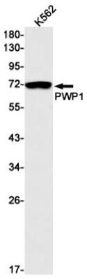 Western Blot: PWP1 Antibody (S01-7B5) [NBP3-19752] - Western blot detection of PWP1 in K562 cell lysates using NBP3-19752 (1:1000 diluted). Predicted band size: 56kDa. Observed band size: 75kDa.