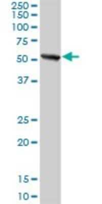 Western Blot: PWP1 Antibody [H00011137-D01P] - Analysis of PWP1 expression in human pancreas.