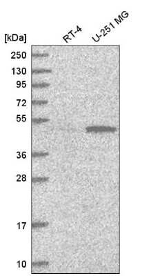 Western Blot: PWP1 Antibody [NBP2-58751] - Western blot analysis in human cell line RT-4 and human cell line U-251 MG.