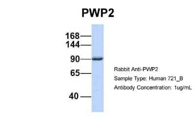 Western Blot: PWP2H Antibody [NBP1-52844] - Analysis of 721_B cell lysate. Antibody Dilution: 1.0 ug/ml PWP2 is supported by BioGPS gene expression data to be expressed in 721_B.