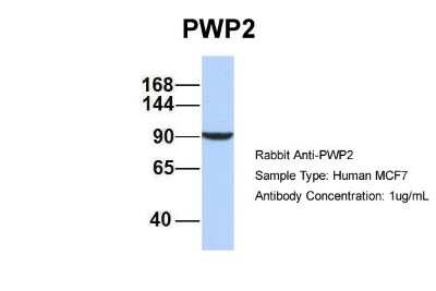 Western Blot: PWP2H Antibody [NBP1-52844] - Sample Type: MCF7 Antibody Dilution: 1.0 ug/ml PWP2 is supported by BioGPS gene expression data to be expressed in MCF7
