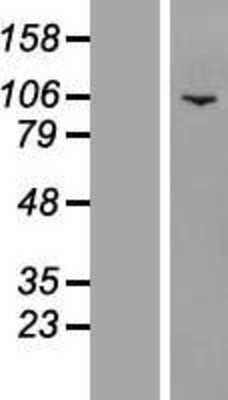 Western Blot: PWP2H Overexpression Lysate (Adult Normal) [NBL1-15010] Left-Empty vector transfected control cell lysate (HEK293 cell lysate); Right -Over-expression Lysate for PWP2H.