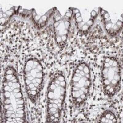 Immunohistochemistry-Paraffin: PWWP2B Antibody [NBP3-17422] - Staining of human rectum shows strong nuclear positivity in glandular cells.