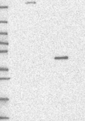 Western Blot: PWWP2B Antibody [NBP3-17422] - Lane 1: Marker [kDa] 250, 130, 95, 72, 55, 36, 28, 17, 10;   Lane 2: RT4;   Lane 3: U-251 MG;   Lane 4: Human Plasma;   Lane 5: Liver;   Lane 6: Tonsil