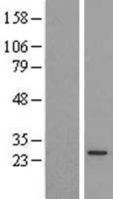 Western Blot: PX19 Overexpression Lysate (Adult Normal) [NBL1-14745] Left-Empty vector transfected control cell lysate (HEK293 cell lysate); Right -Over-expression Lysate for PX19.