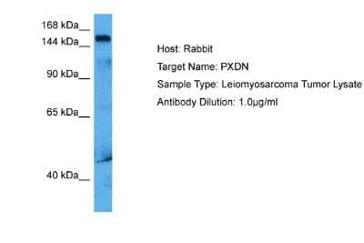 Western Blot: PXDN Antibody [NBP2-84232] - Host: Rabbit. Target Name: PXDN. Sample Tissue: Human Leiomyosarcoma lysates. Antibody Dilution: 1ug/ml