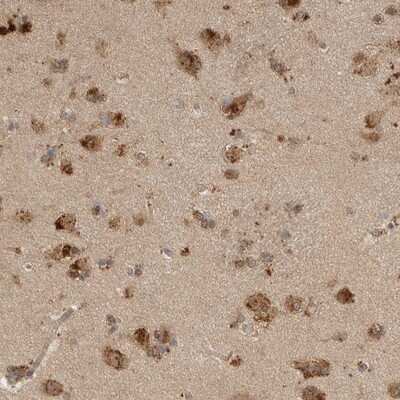 Immunohistochemistry-Paraffin PXK Antibody