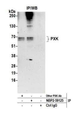 Immunoprecipitation: PXK Antibody [NBP2-59125] - Detection of human PXK by western blot of immunoprecipitates. Samples: Whole cell lysate (0.5 or 1.0 mg per IP reaction; 20% of IP loaded) from 293T cells prepared using NETN lysis buffer. Antibodies: Affinity purified rabbit anti-PXK antibody NBP2-59125 used for IP at 8 ul per reaction. PXK was also immunoprecipitated by another rabbit anti-PXK antibody. Detection: Chemiluminescence with an exposure time of 30 seconds.