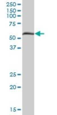 Western Blot: PXK Antibody [H00054899-B01P] - Analysis of PXK expression in rat brain.